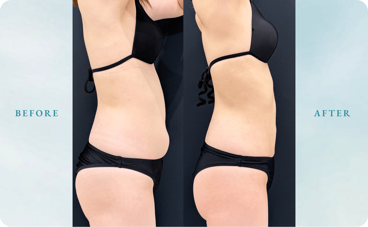 BeforeAfter画像