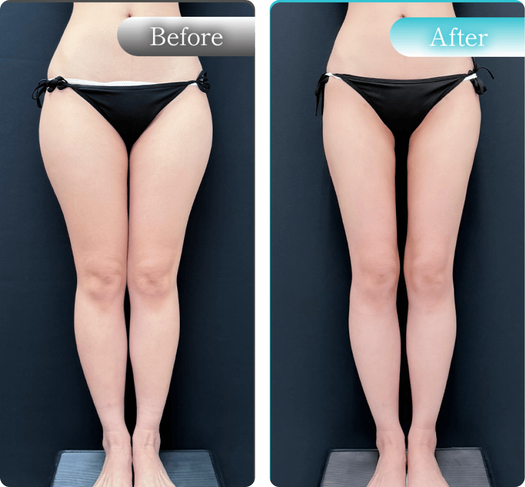BeforeAfter画像