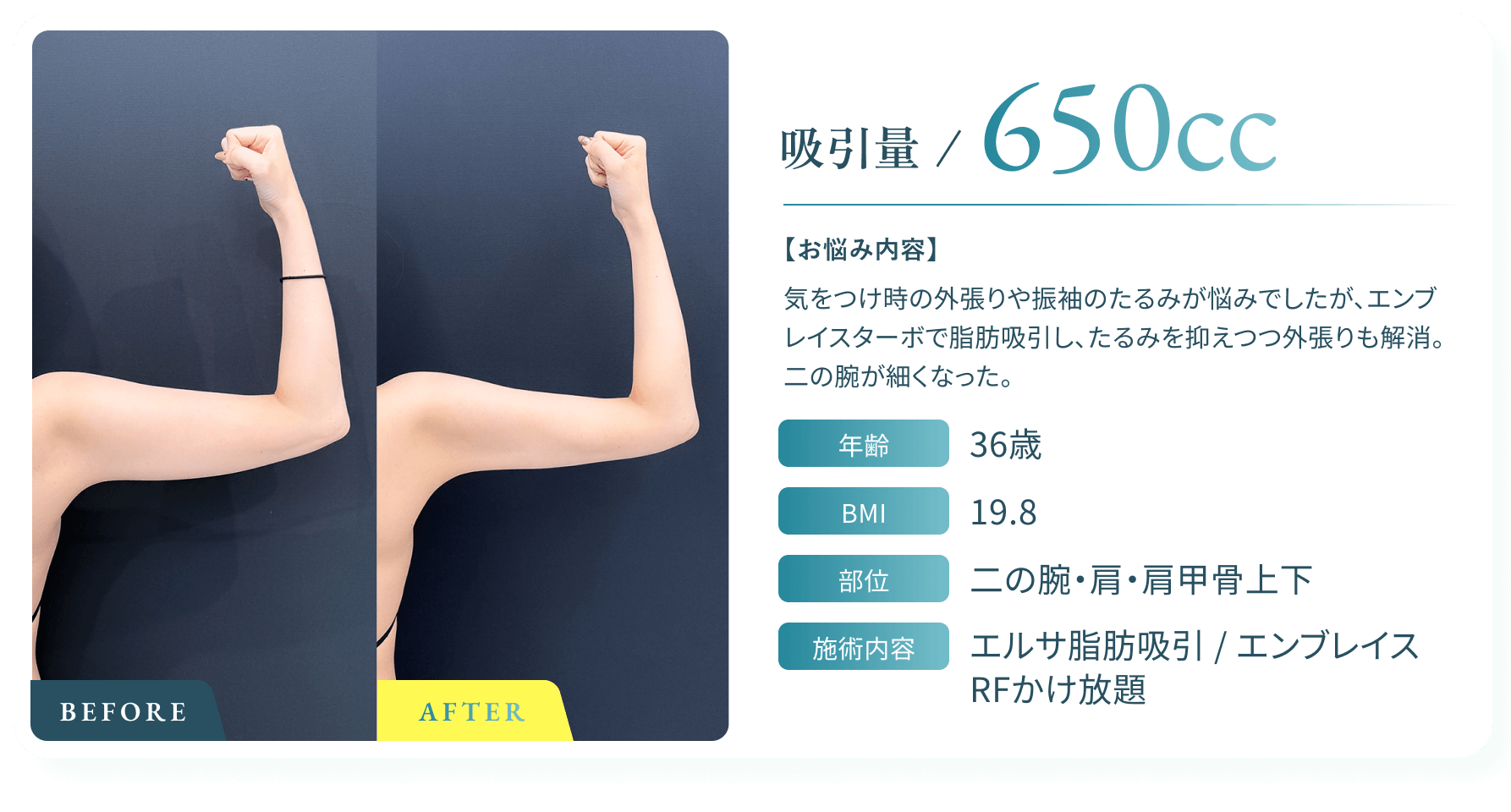 BeforeAfter画像