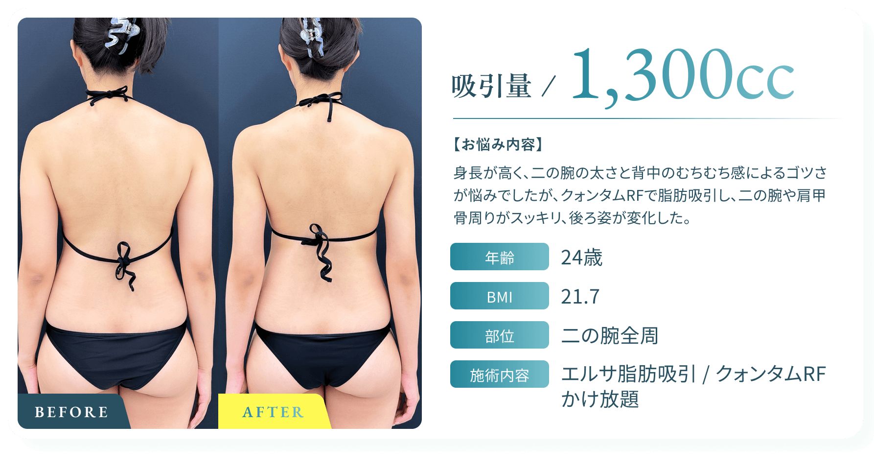 BeforeAfter画像