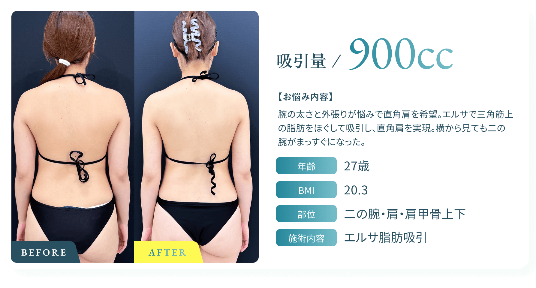 BeforeAfter画像