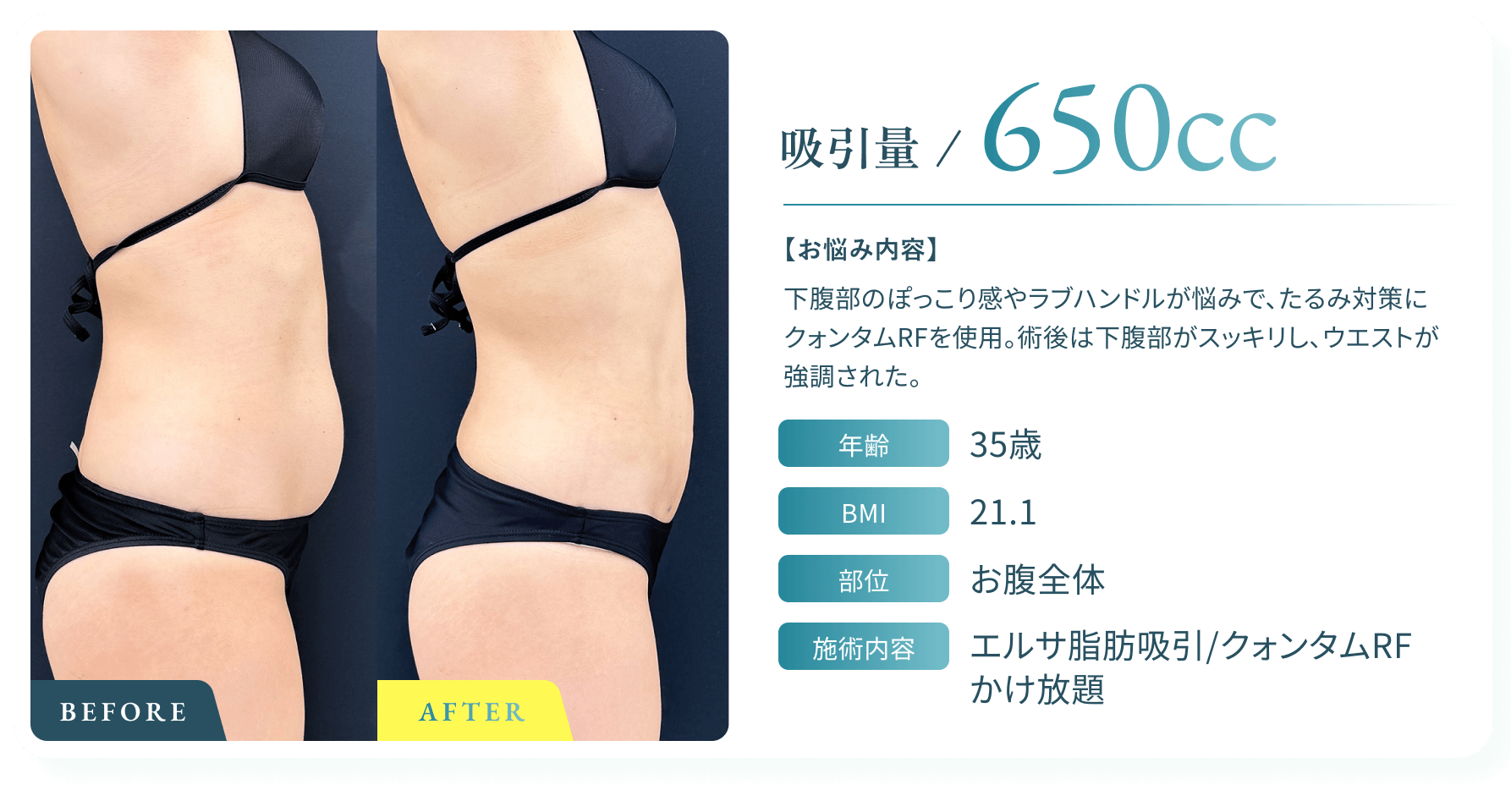 BeforeAfter画像