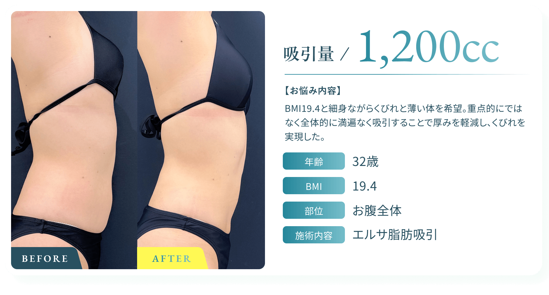 BeforeAfter画像