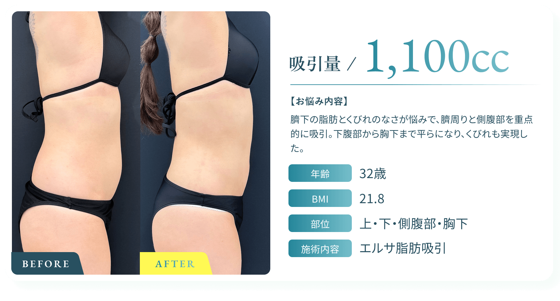 BeforeAfter画像