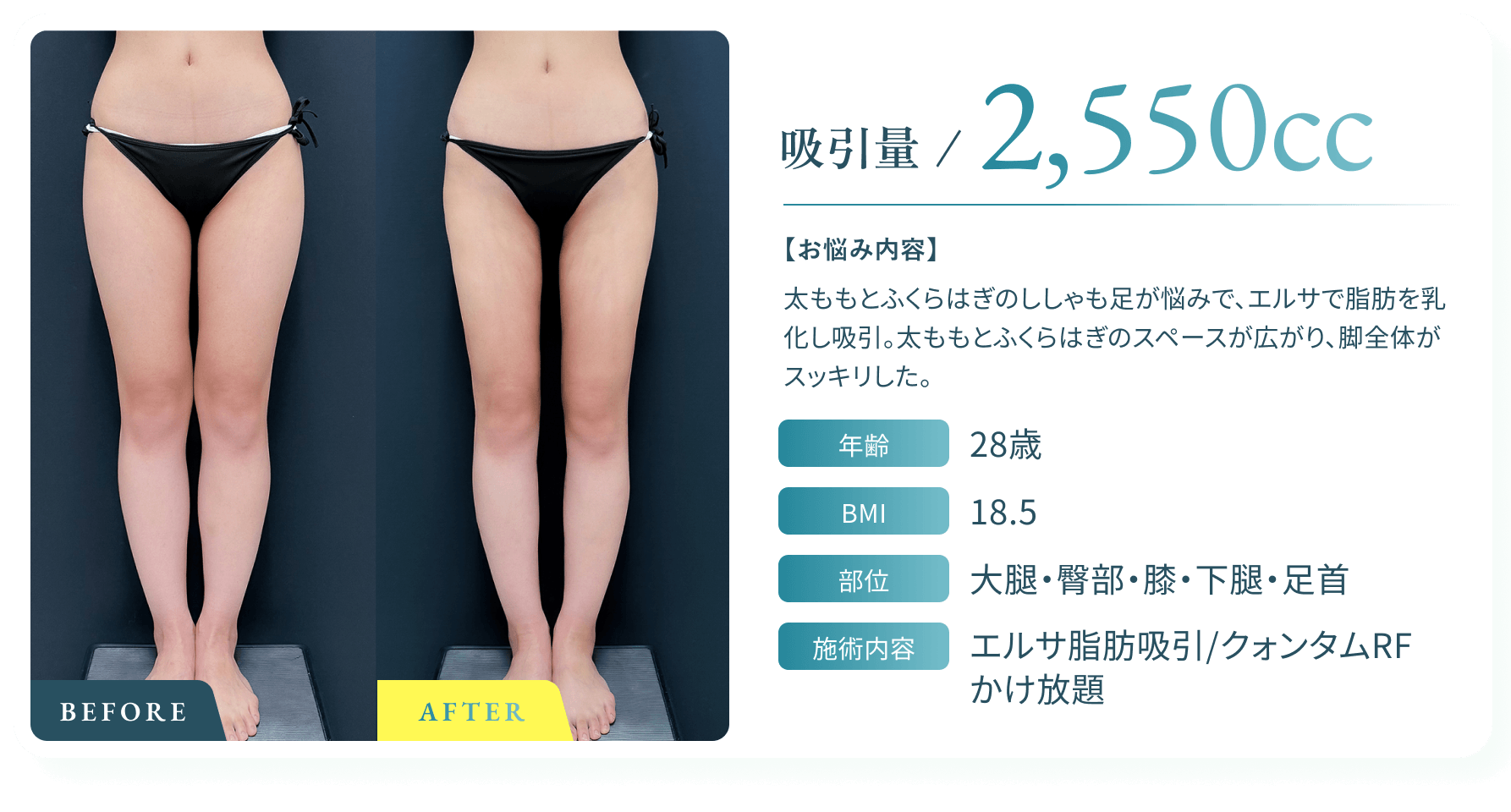 BeforeAfter画像