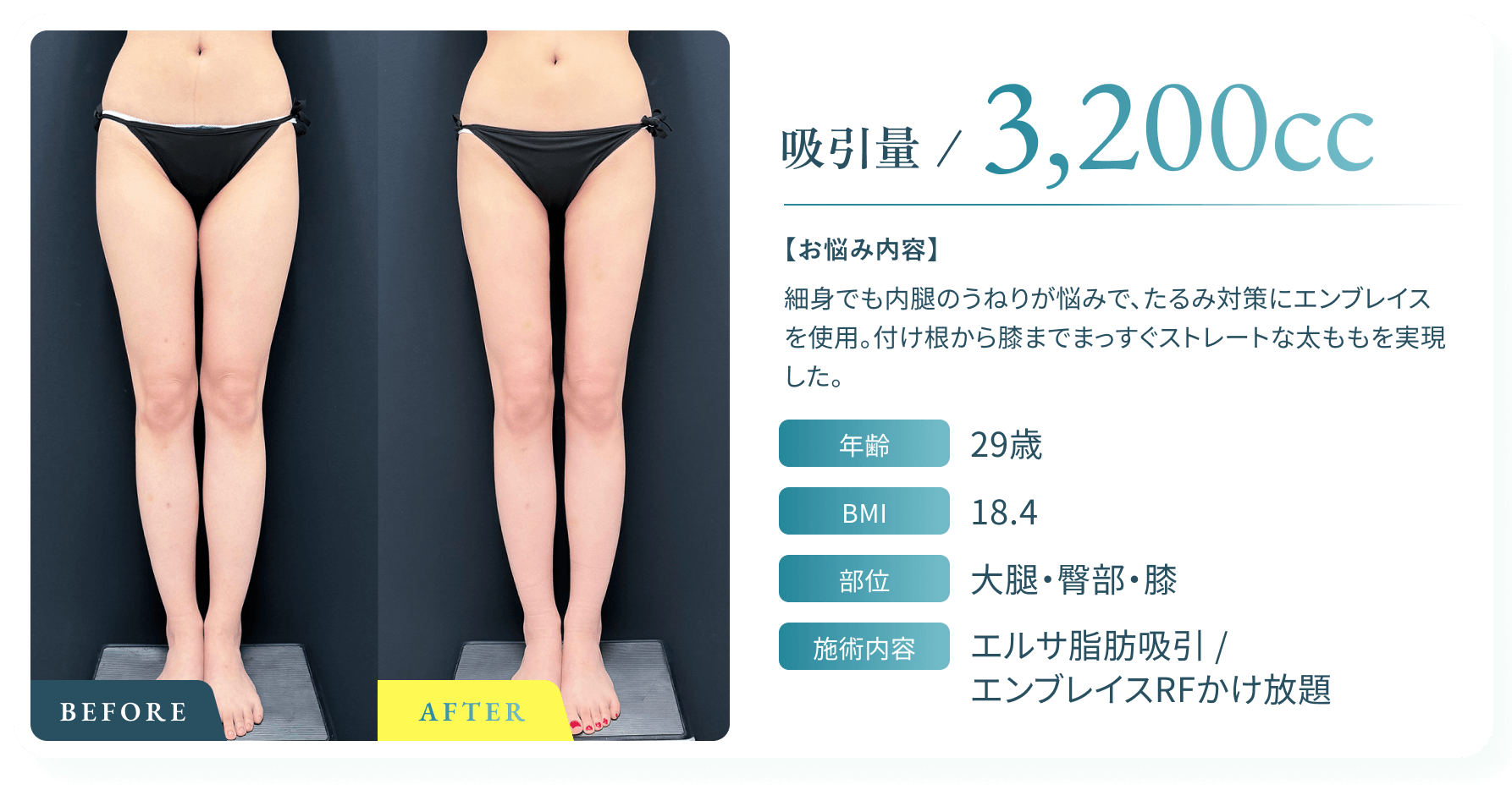 BeforeAfter画像