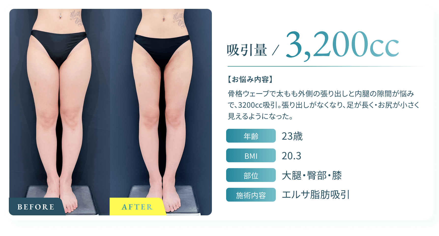 BeforeAfter画像