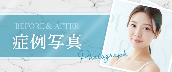 症例写真