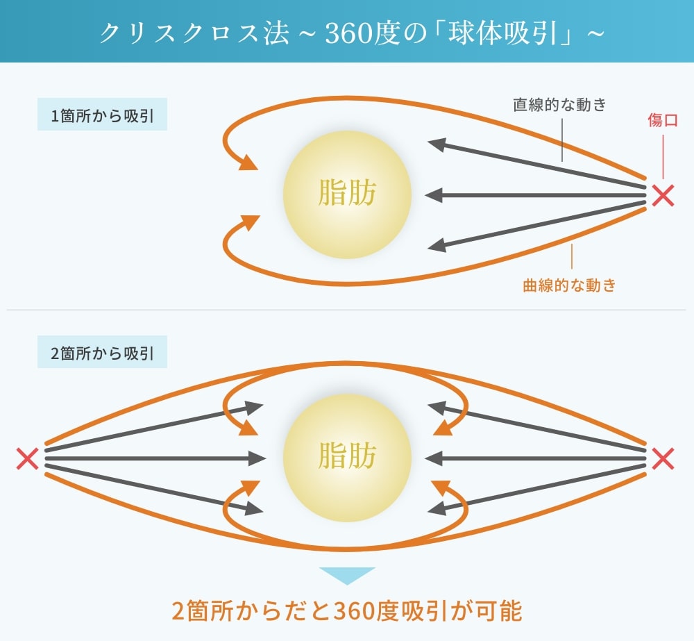クリスクロス法