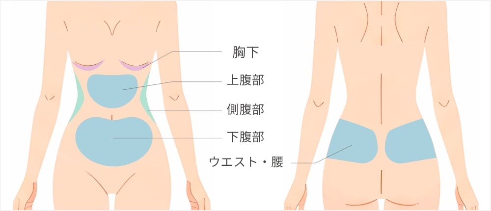 お腹・ウエスト・脂肪吸引脂肪吸引