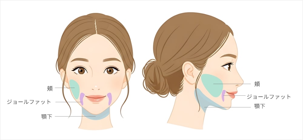 東京新宿Purelys TOKYO CLINICの顔の脂肪吸引箇所