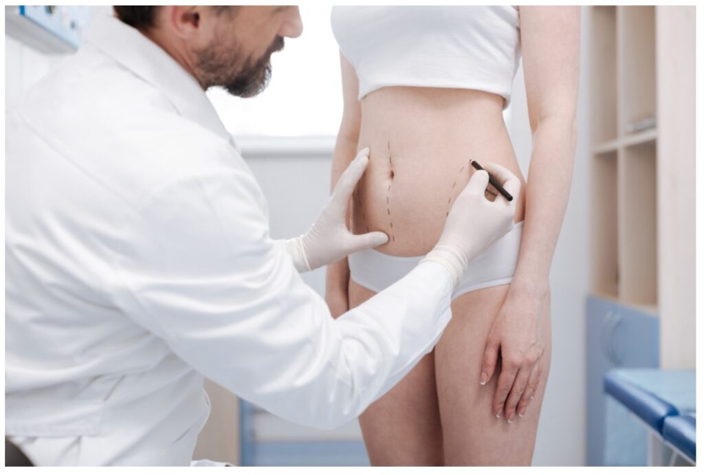 マーキング・デザイン