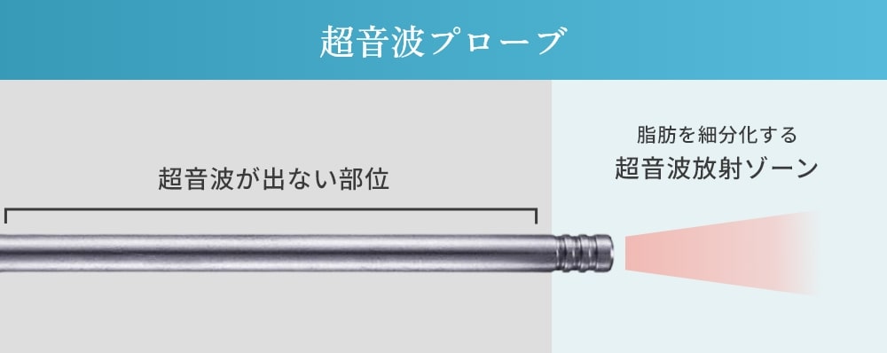 超音波プローブ
