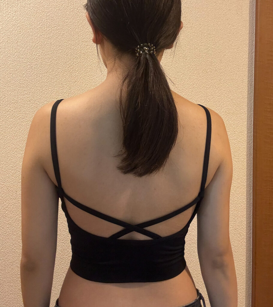 二の腕の脂肪吸引
