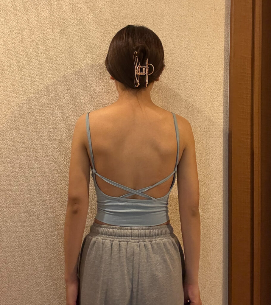 二の腕の脂肪吸引