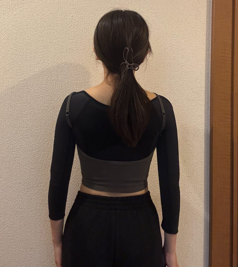 二の腕の脂肪吸引