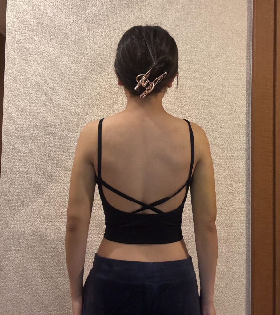 二の腕の脂肪吸引