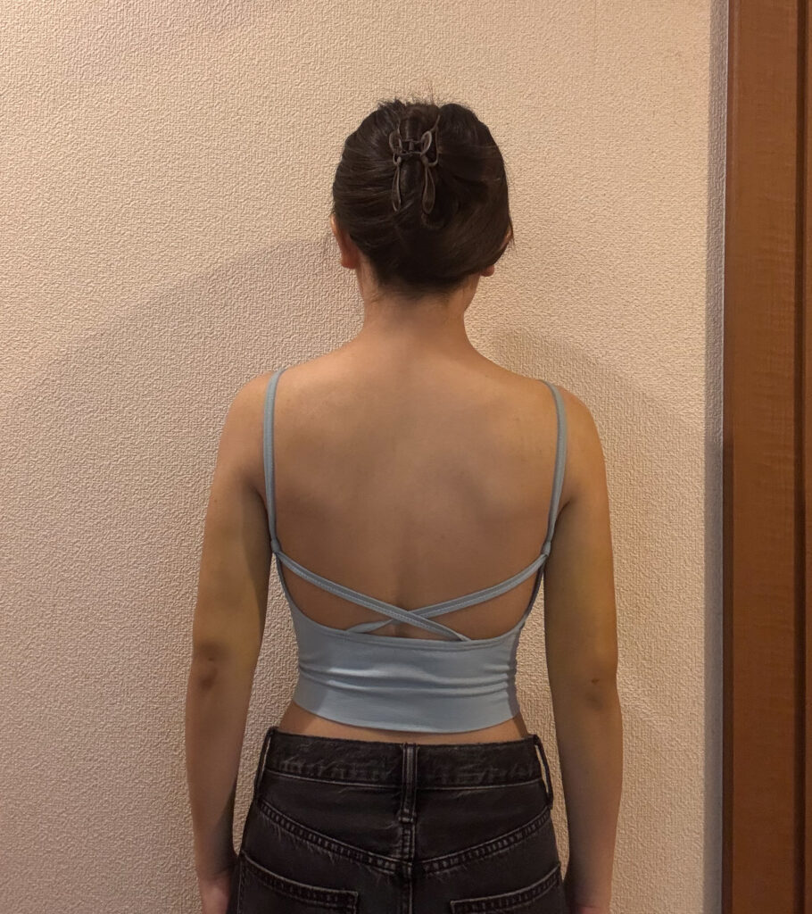 二の腕の脂肪吸引