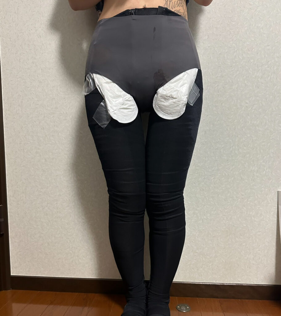 足の脂肪吸引