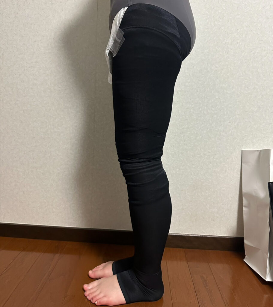 足の脂肪吸引