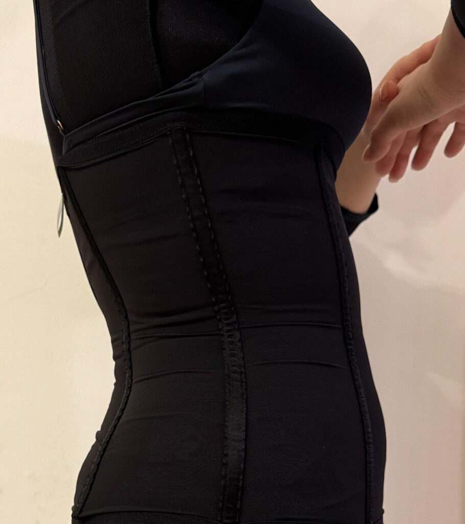 お腹の脂肪吸引