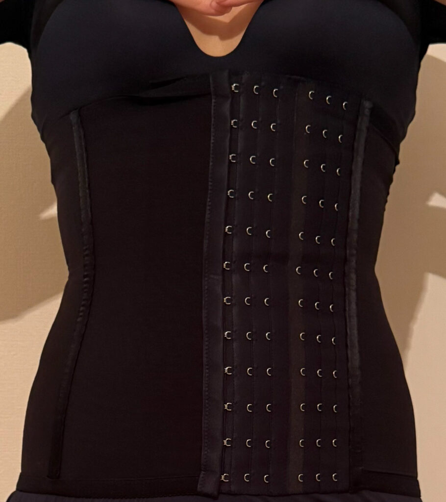 お腹の脂肪吸引