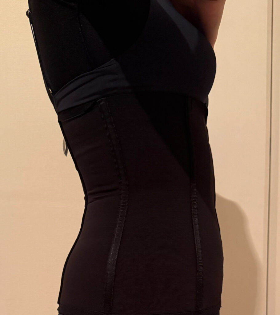 お腹の脂肪吸引