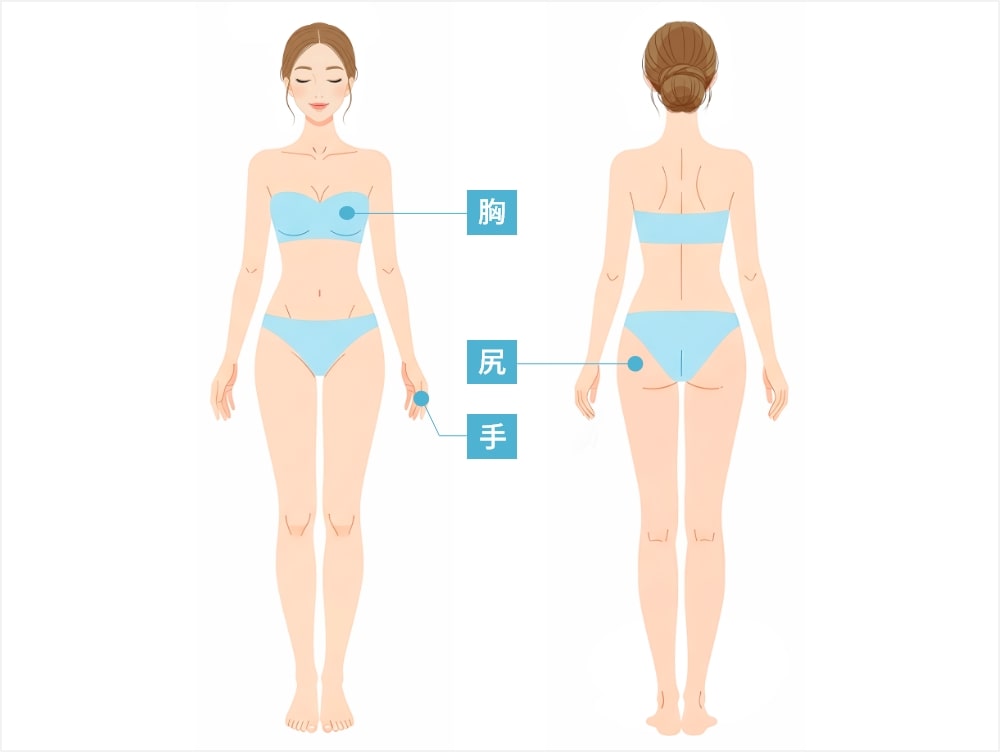 ボディの脂肪注入の施術箇所