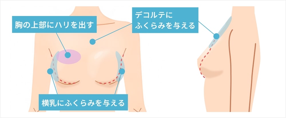 バストの自然なボリュームアップ