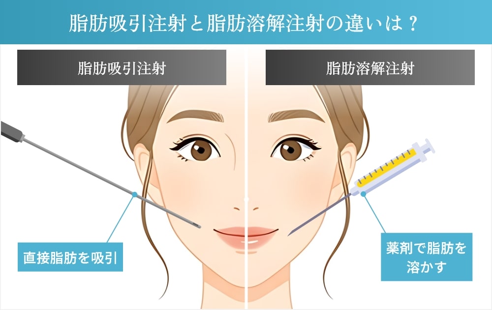 脂肪吸引注射と脂肪溶解注射の違い