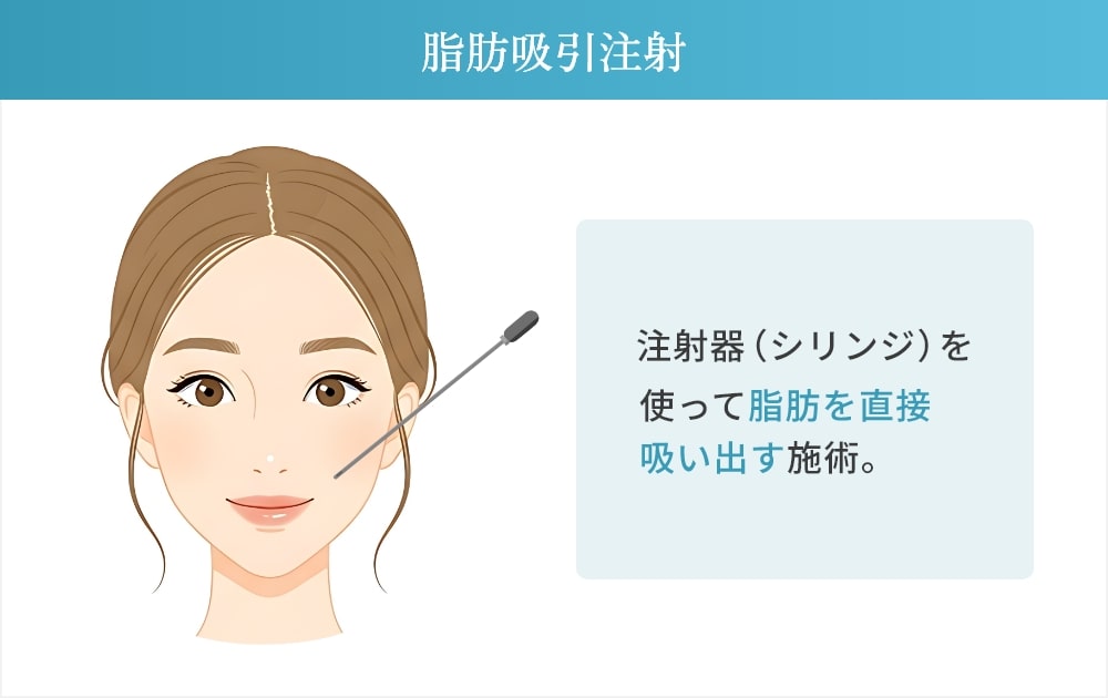 脂肪吸引注射とは