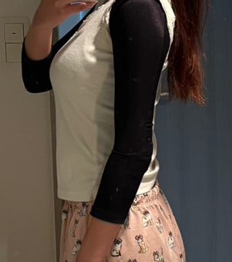 二の腕の脂肪吸引