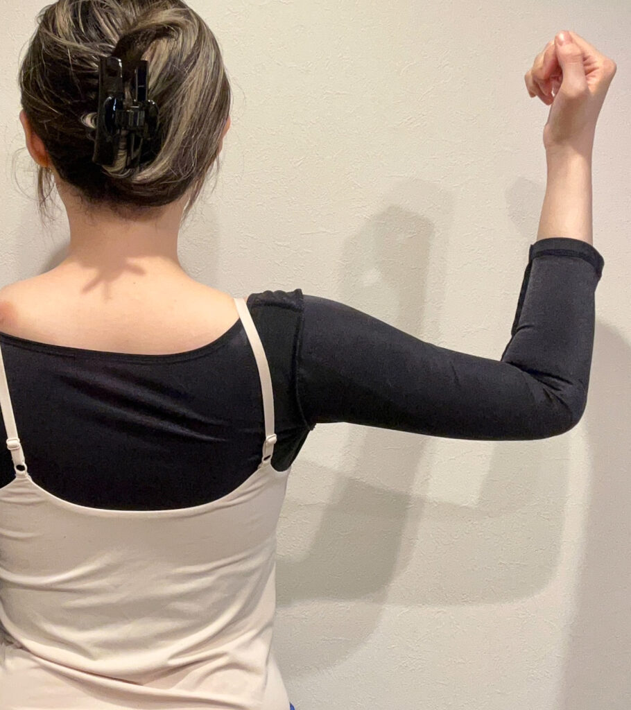 二の腕の脂肪吸引