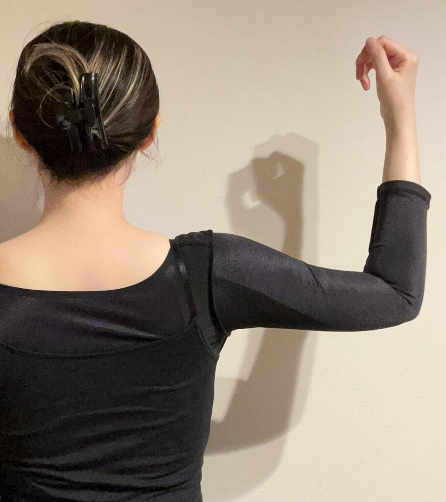 二の腕の脂肪吸引