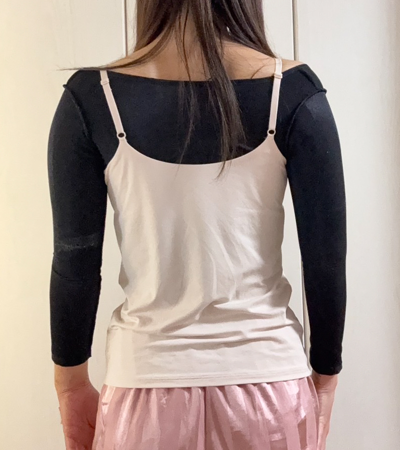 二の腕の脂肪吸引