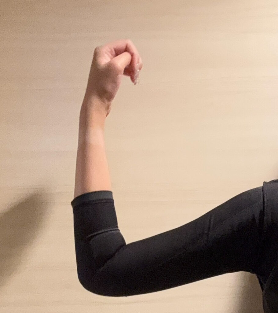 二の腕の脂肪吸引