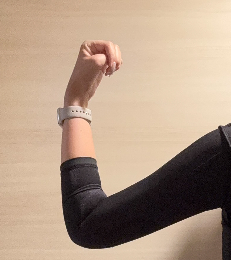 二の腕の脂肪吸引