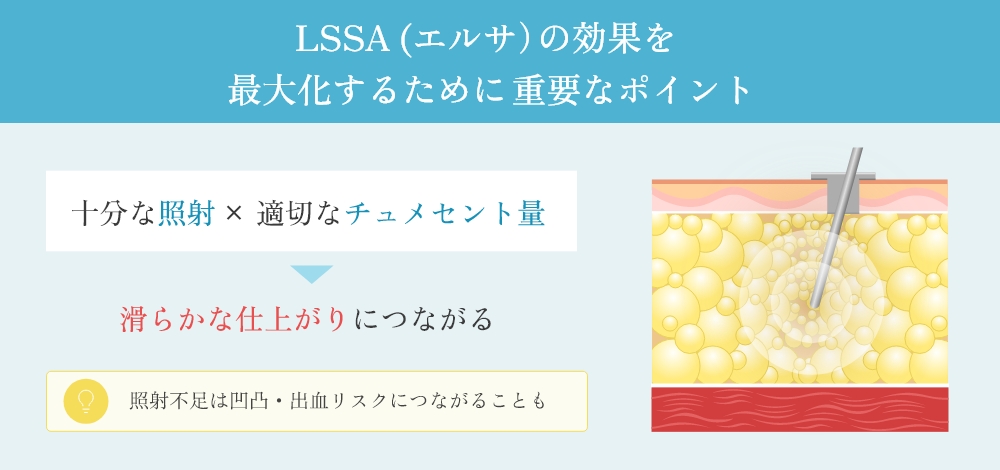 効果を引き出すためのポイント