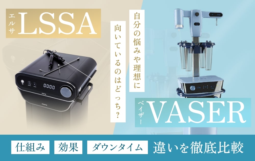 LSSA(エルサ)とVASER(ベイザー)の違い