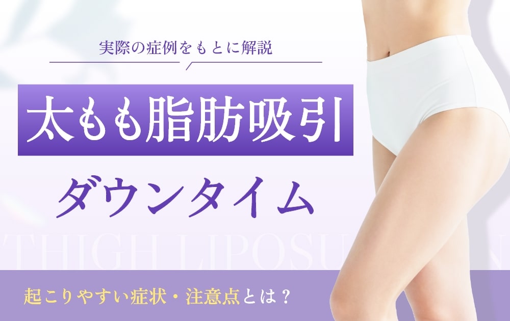 太もも脂肪吸引 ダウンタイム