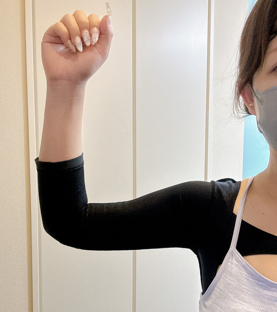 二の腕の脂肪吸引