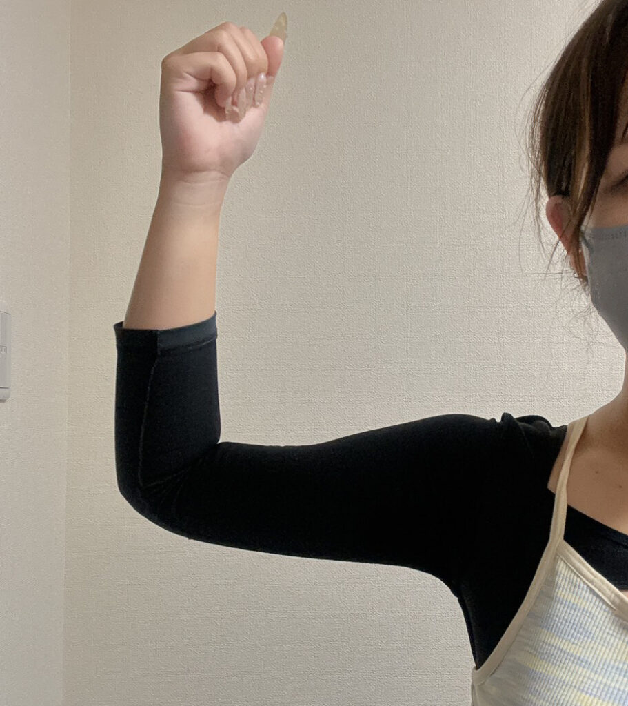 二の腕の脂肪吸引
