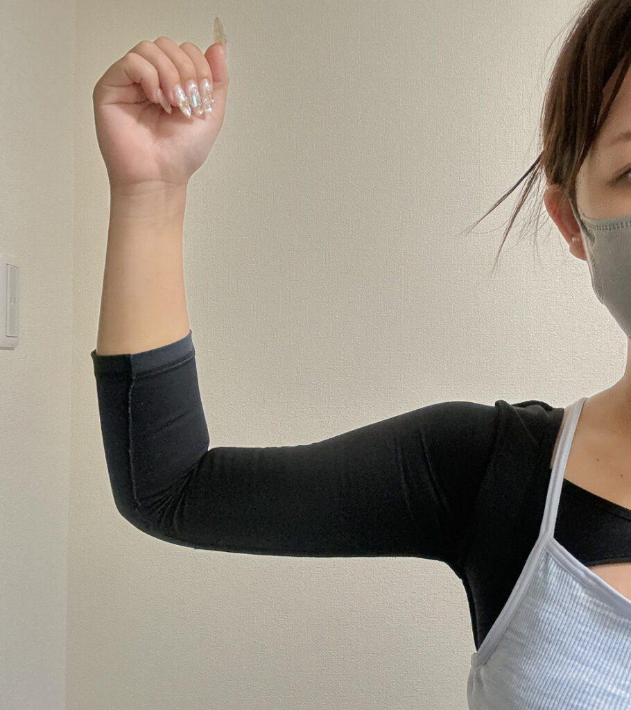 二の腕の脂肪吸引