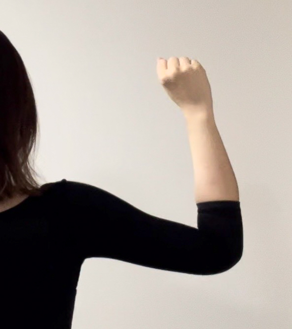 二の腕の脂肪吸引