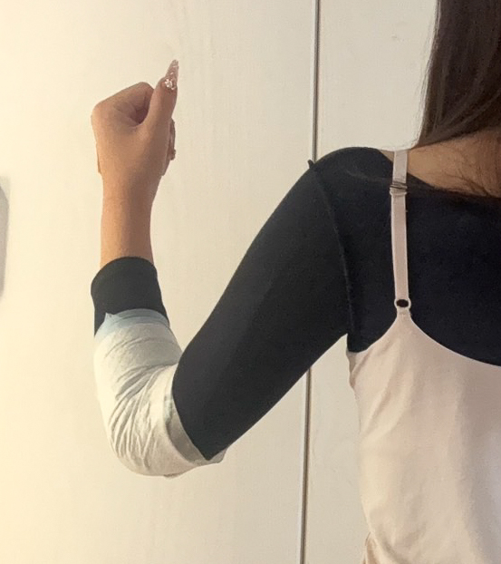 二の腕の脂肪吸引