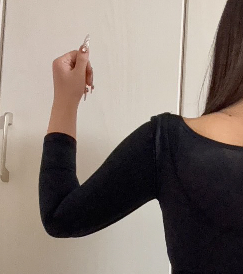 二の腕の脂肪吸引