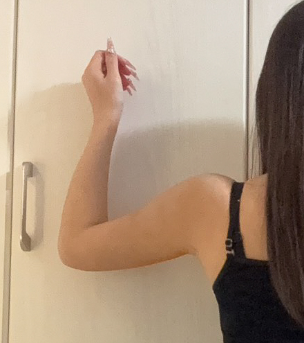 二の腕の脂肪吸引