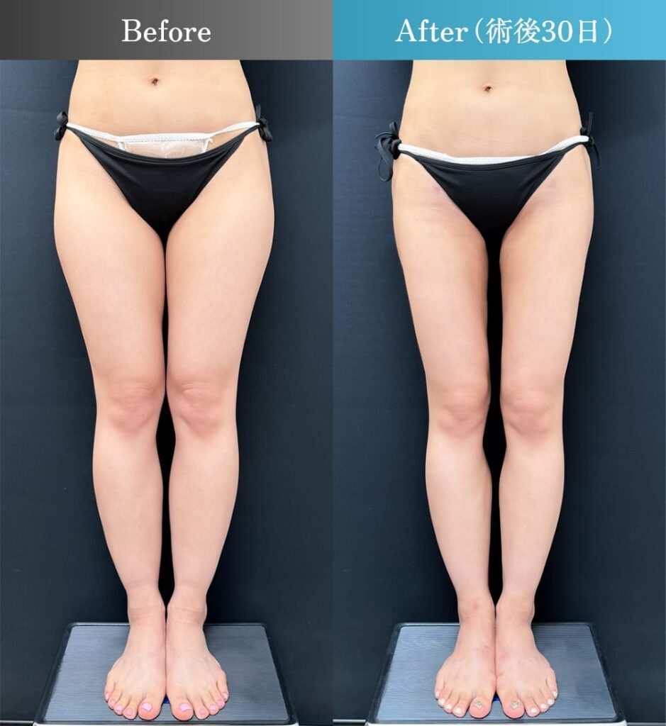 東京新宿の脂肪吸引の名医】三浦航医師が教える“本当に信頼できる医師