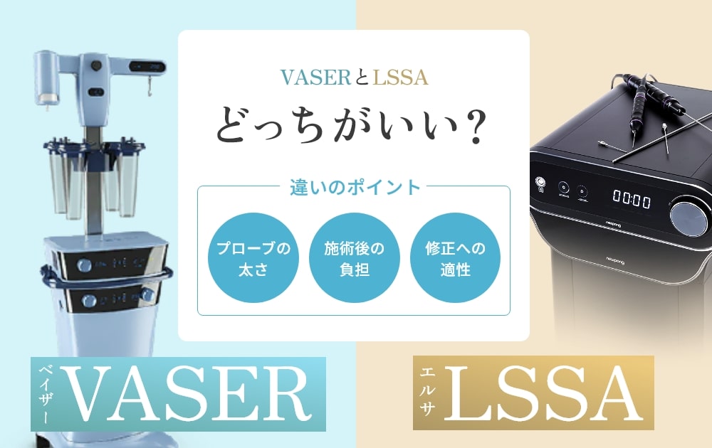 エルサとベイザーの比較