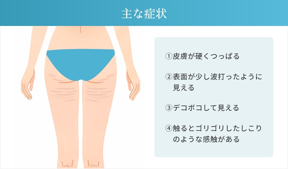 拘縮の主な症状